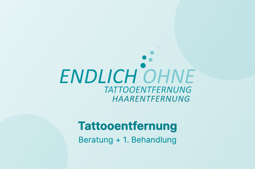 Beratung - Laser Tattooentfernung + 1. Behandlung